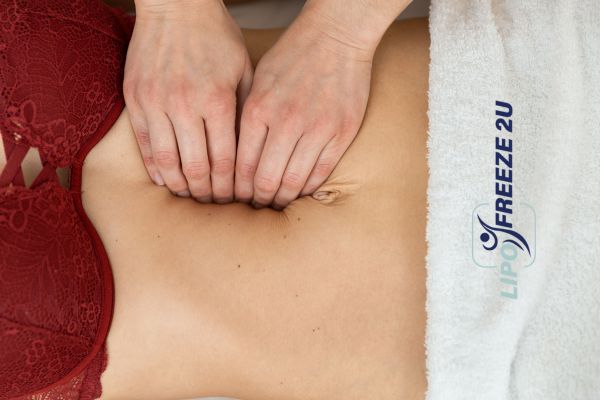 diastasis recti treatment Uxbridge