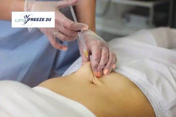 Fat Dissolving Injections Uxbridge & Weight loss medication