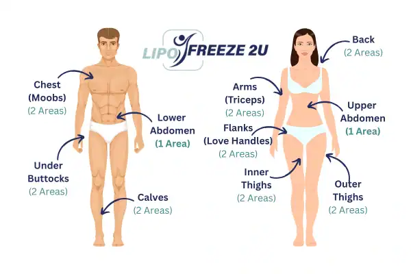 Areas you can have fat freezing treatment Uxbridge