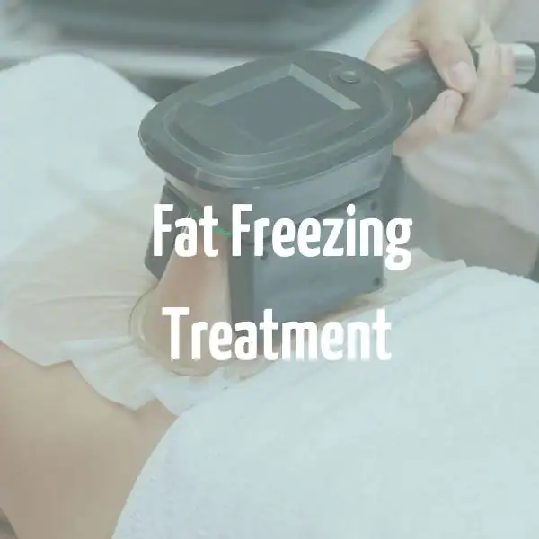 fat freezing treatment Uxbridge
