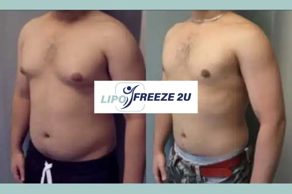 How Long Does It Take to See Results Uxbridge?