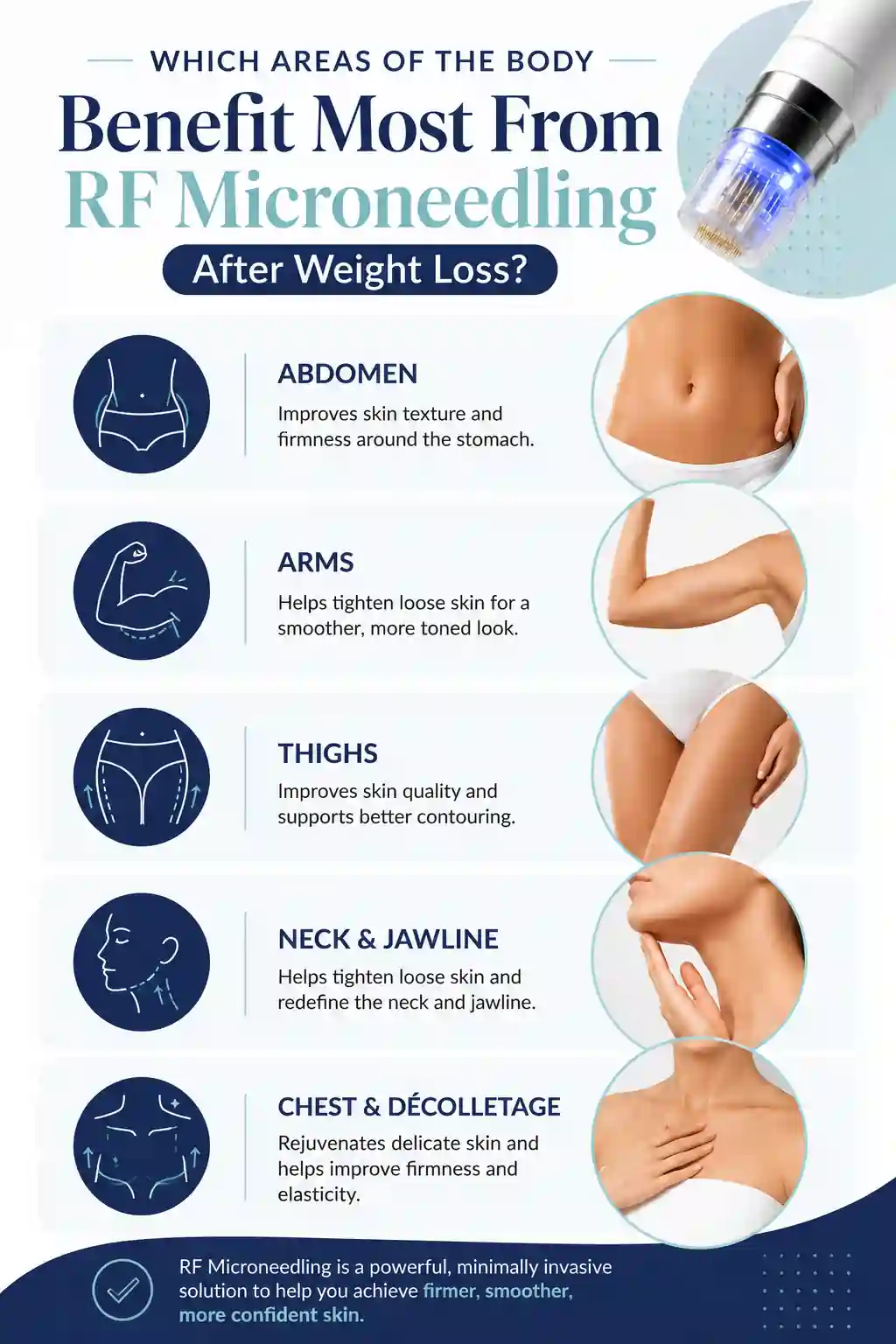 Which Areas of the Body Benefit Most From RF Microneedling After Weight Loss Uxbridge
